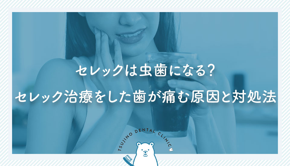 セレックは虫歯になる？セレック治療をした歯が痛む原因と対処法｜伊丹の歯医者つじの歯科医院