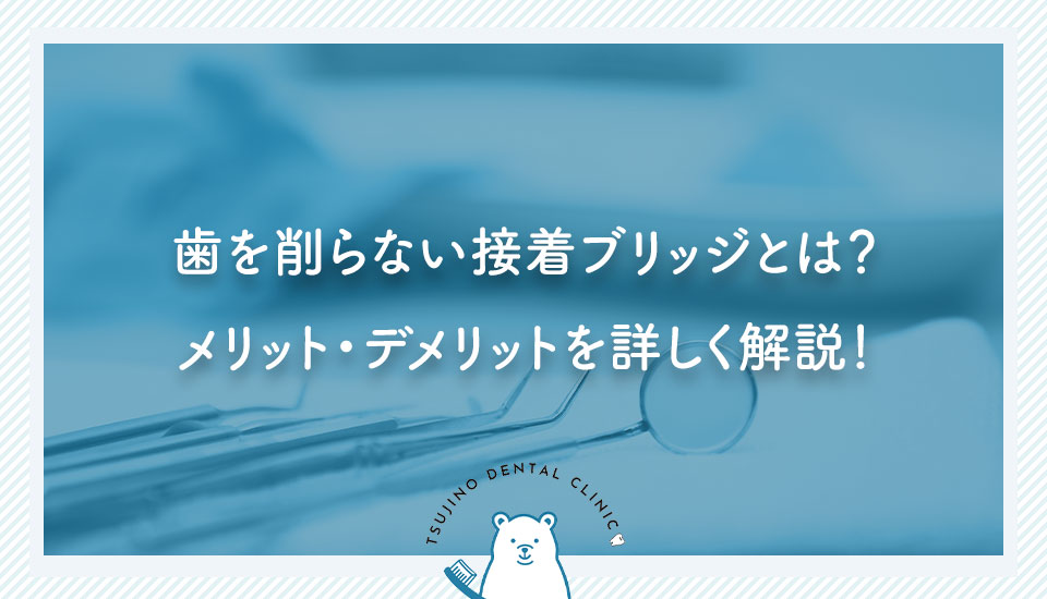 歯を削らない接着ブリッジとは？メリット・デメリットを詳しく解説！｜伊丹の歯医者つじの歯科医院