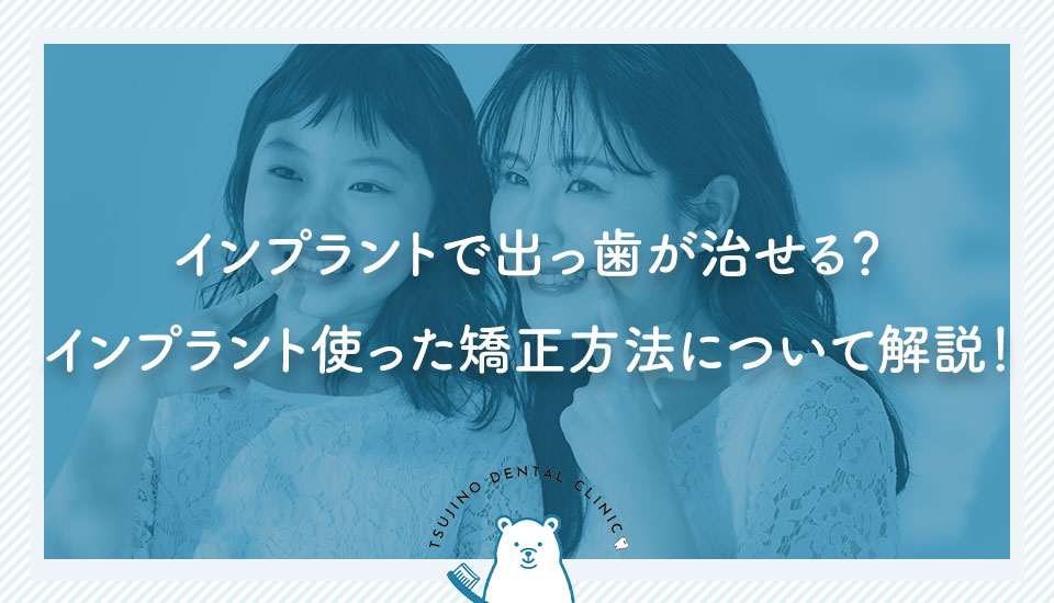 インプラントで出っ歯が治せる？インプラント使った矯正方法について解説！｜伊丹の歯医者つじの歯科医院