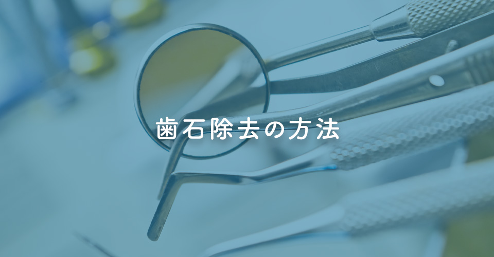 歯石除去の方法