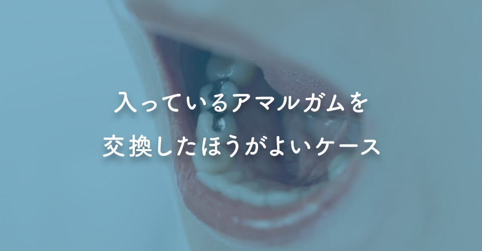 入っているアマルガムを交換したほうがよいケース