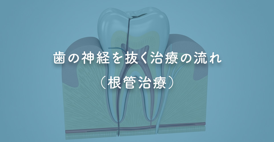 歯の神経を抜く治療の流れ（根管治療）